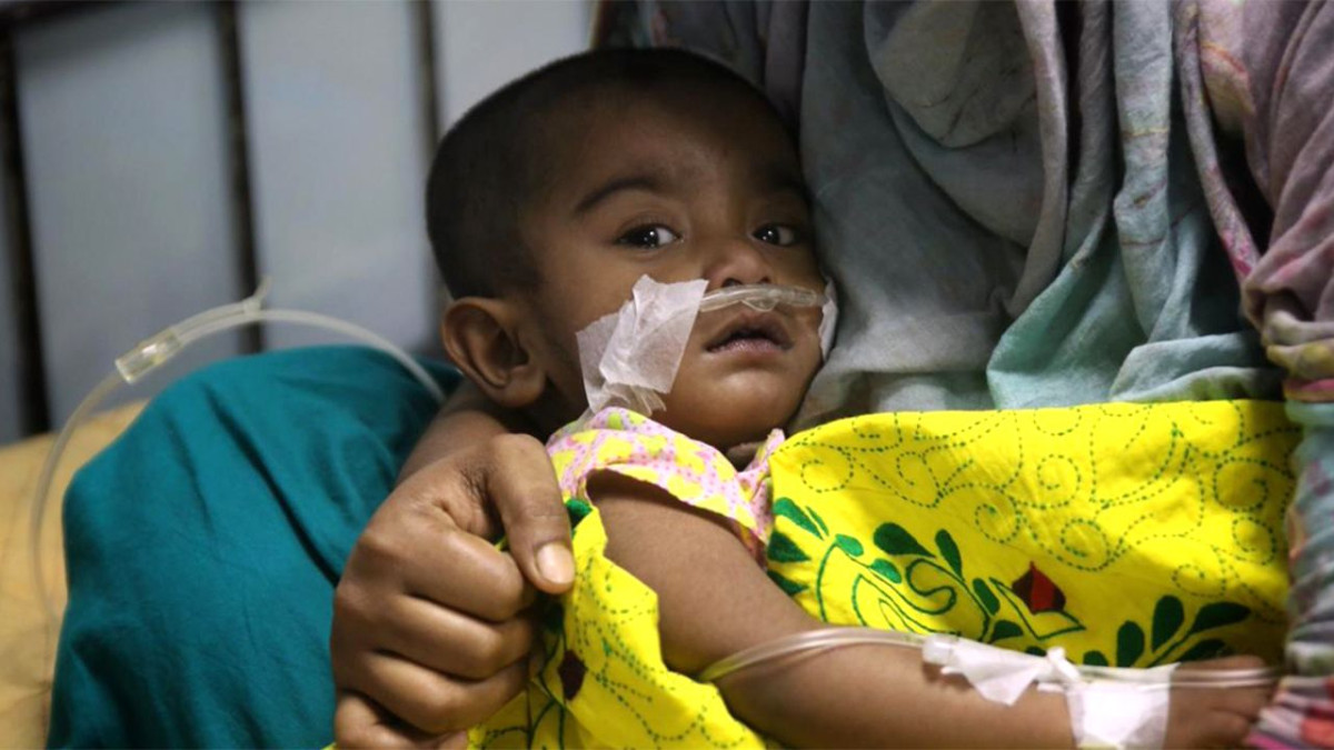 হামের উপসর্গে আরো ৭ শিশুর মৃত্যু, আক্রান্ত ১২৭৩