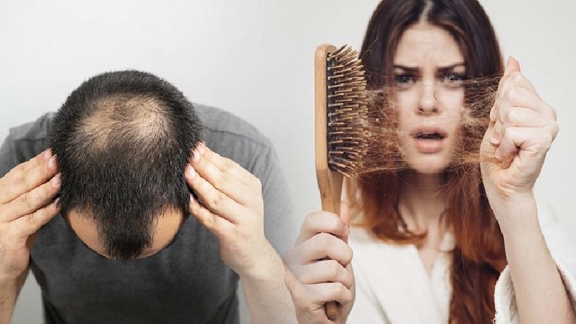 চুল পড়া থামানোর কি আসলে কোনো সল্যুশন আছে?